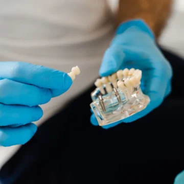 implant-dentar-mc-dental-implant-odobesti Implant dentar aproape de Focșani: etape, sisteme de implant și tarife