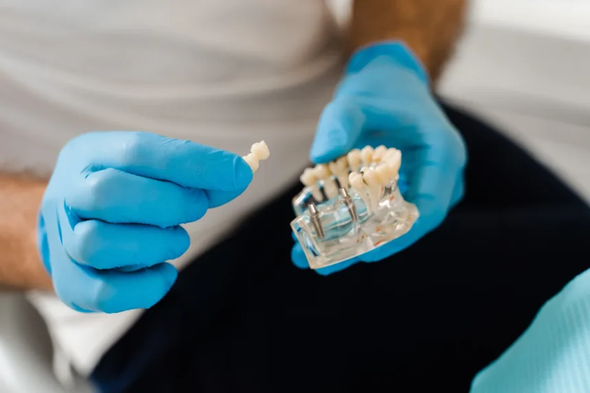 implant-dentar-mc-dental-implant-odobesti Implant dentar aproape de Focșani: etape, sisteme de implant și tarife